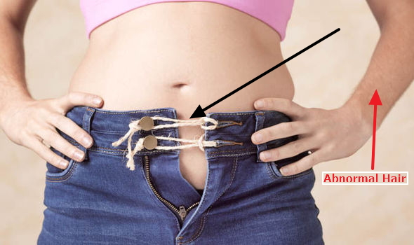 Bloating & PMS Bloating & PMS